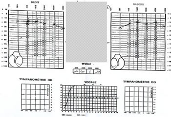 Audition Retrouv�e